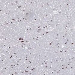 Protocadherin beta 8 Antibody, Novus Biologicals 25 &mu;L | Buy Online | Novus Biologicals | Fisher Scientific